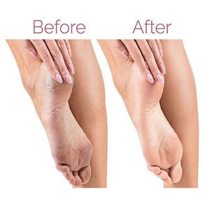 Electric Pedicure Foot File / Callus Remover