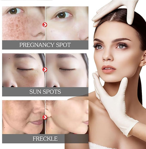 Elhoe Pigment Correcting Cream