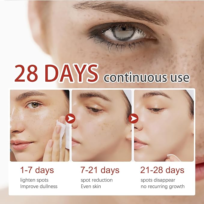 Elhoe Pigment Correcting Cream